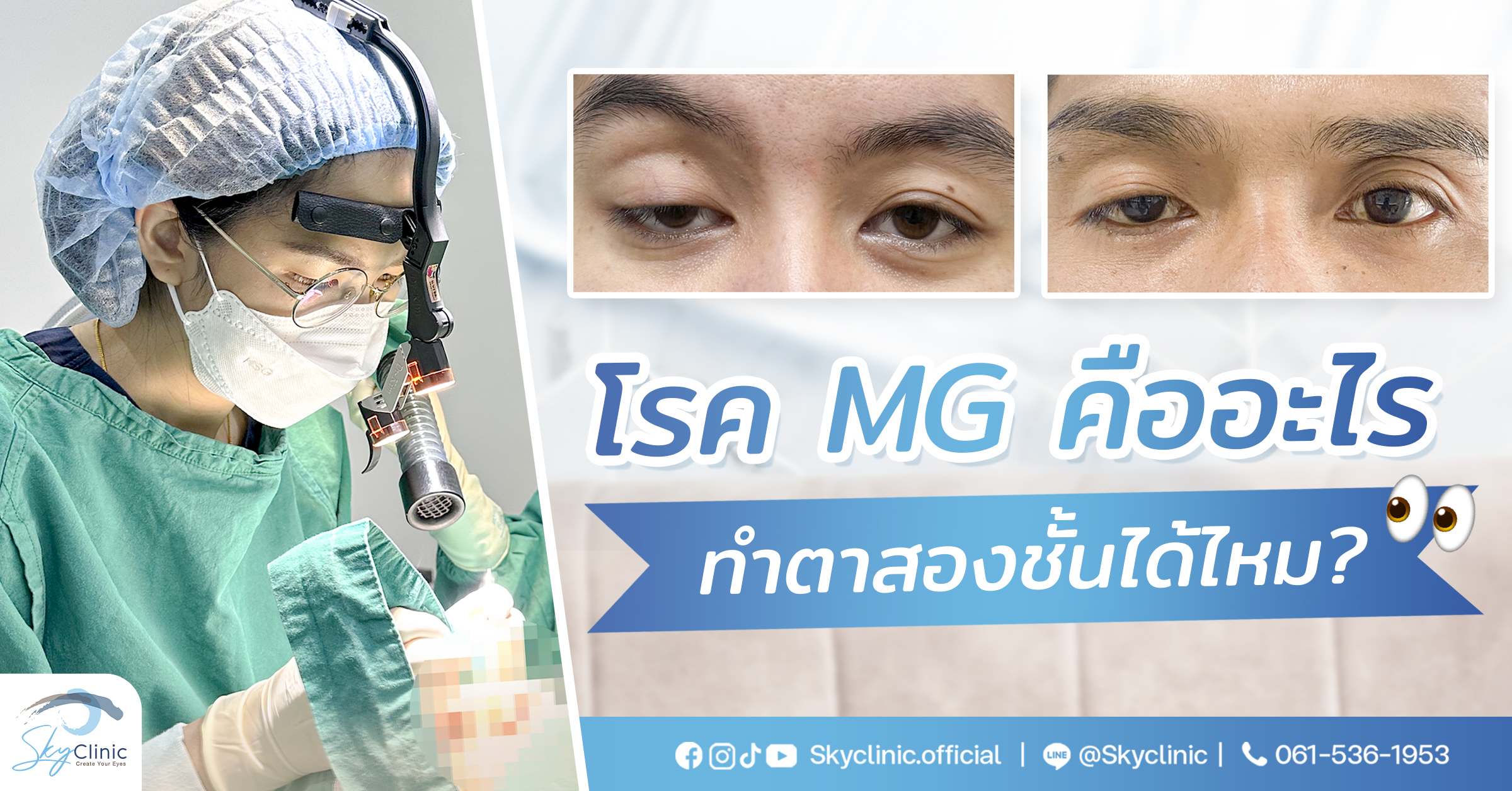 โรค MG คืออะไร ทำตาสองชั้นได้ไหม ?