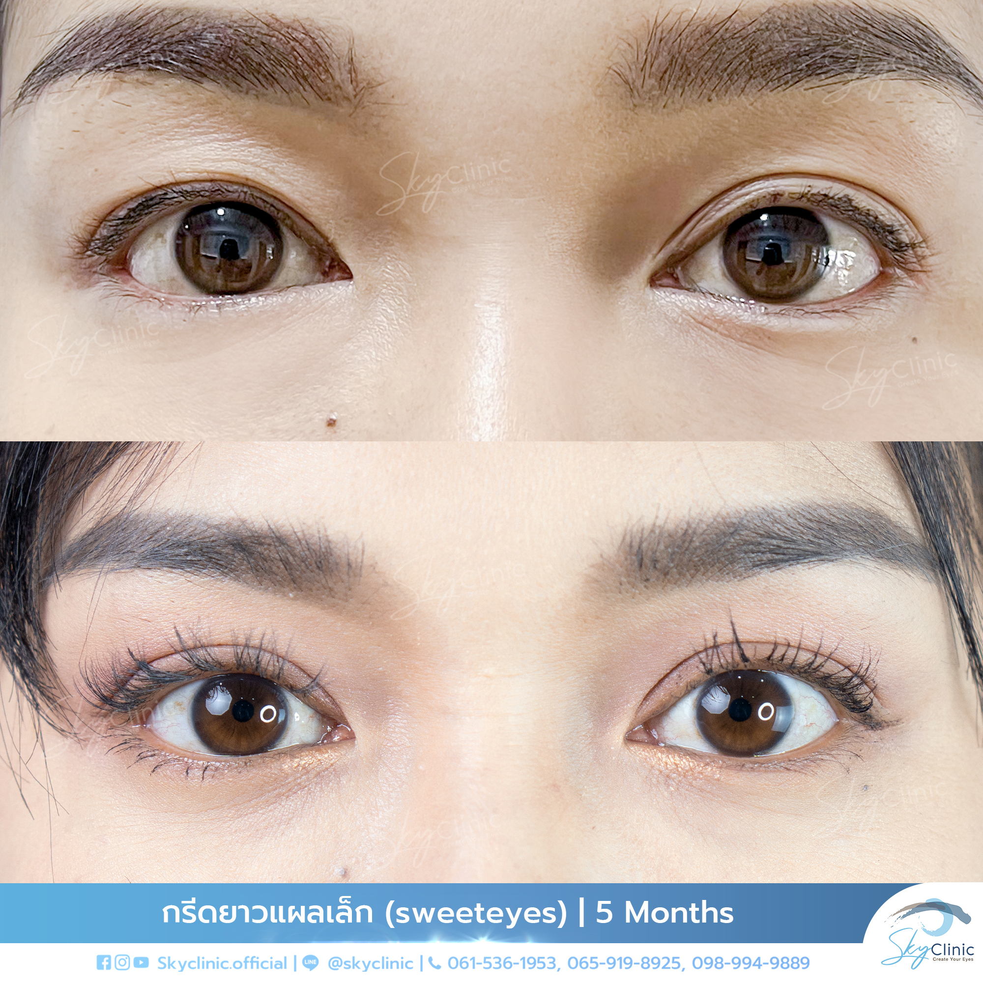 รูปภาพที่อัพโหลด