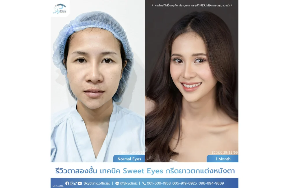 คำอธิบายรูปภาพ