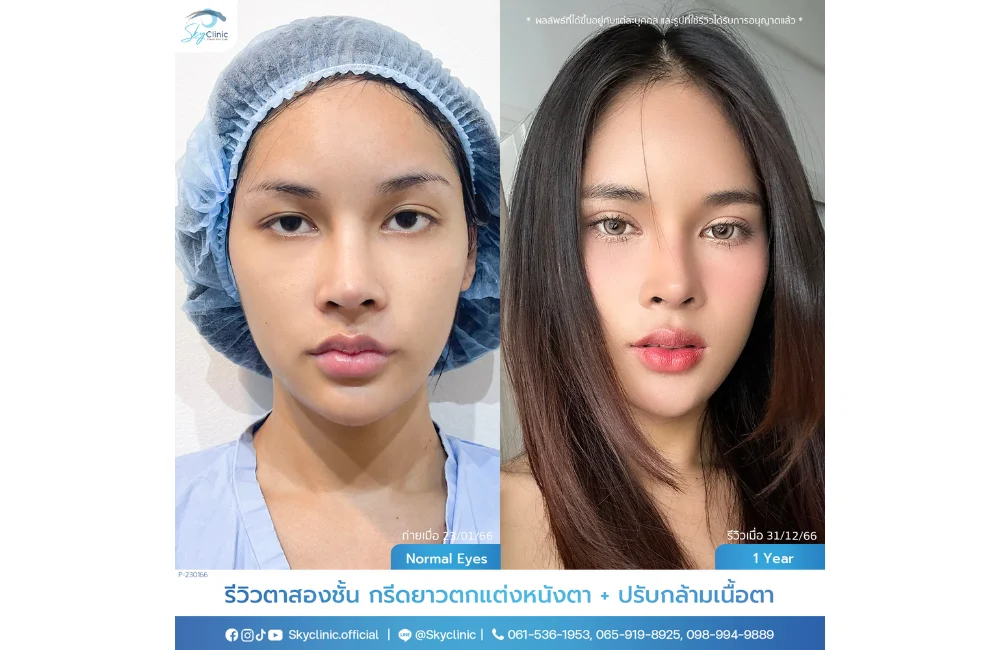 คำอธิบายรูปภาพ
