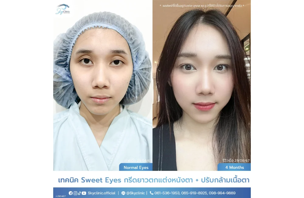 คำอธิบายรูปภาพ