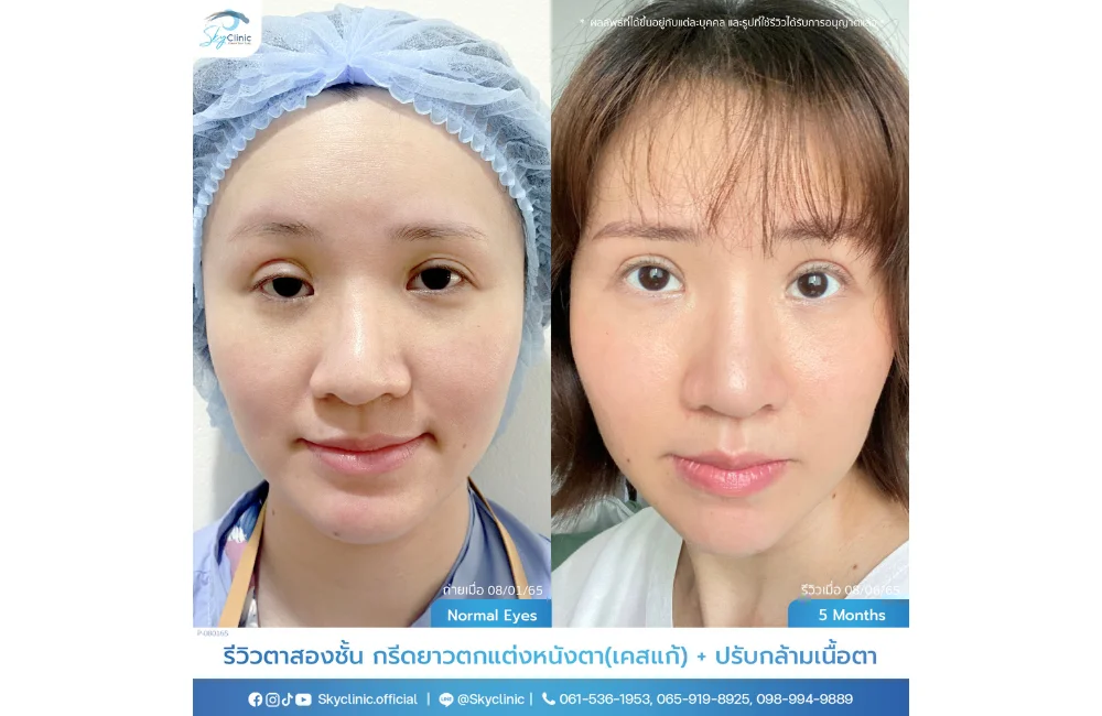 คำอธิบายรูปภาพ