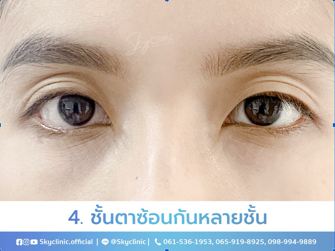 คำอธิบายรูปภาพ